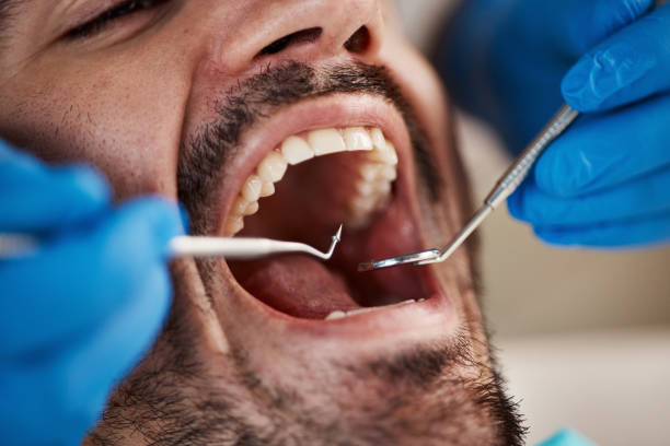 Best Emergency Dental Care for Broken or Chipped Teeth in Pleasant Grove, UT
